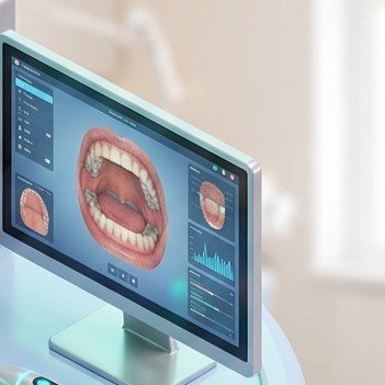 Advanced 3D Dental Equipment and Digital Scanner at Bliss Dental Care